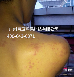 廣州專業(yè)滅臭蟲公司